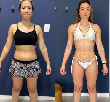 Antes e depois de aluna acompanhada por Sansão Simões